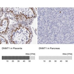 DNMT1 Antibody, Novus Biologicals 0.1mL; Unlabeled:Antibodies, Polyclonal